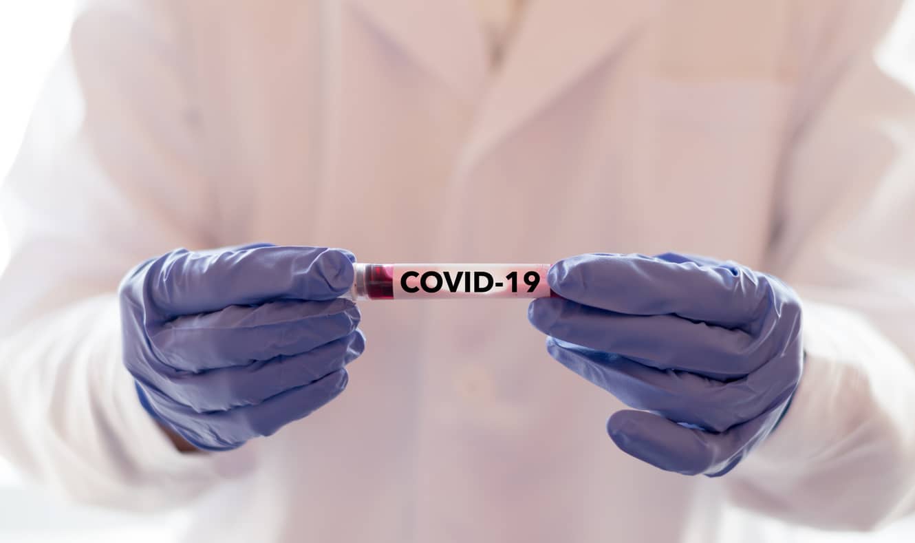 covid-19 blood sample