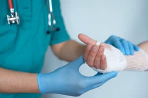 Close up of doctor bandaging one hand after an accident