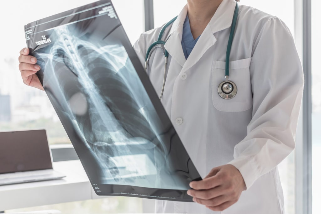 spinal cord injuries